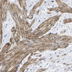 VIGR/GPR126 Antibody, Novus Biologicals 0.1mL; Unlabeled:Antibodies, Polyclonal